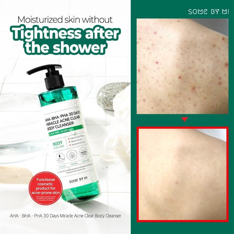 Some By Mi AHA BHA PHA Miracle Acne BODY Cleanser, 400g - Beauty Korea Dubai