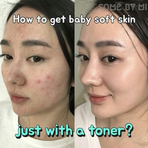 Some By Mi AHA BHA PHA 30Days Miracle Toner,150ml *new packaging - Beauty Korea Dubai