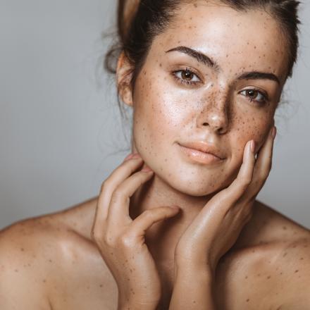 Blemishes, Pigmentation and Dark Spots: All You Need to Know