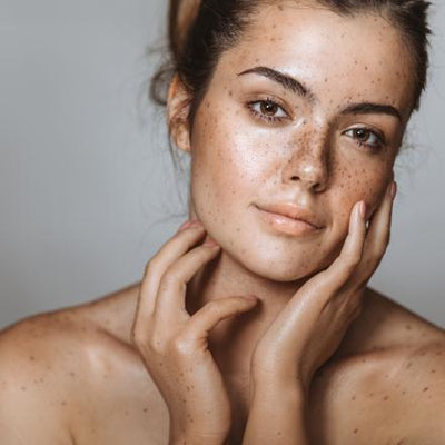Blemishes, Pigmentation and Dark Spots: All You Need to Know