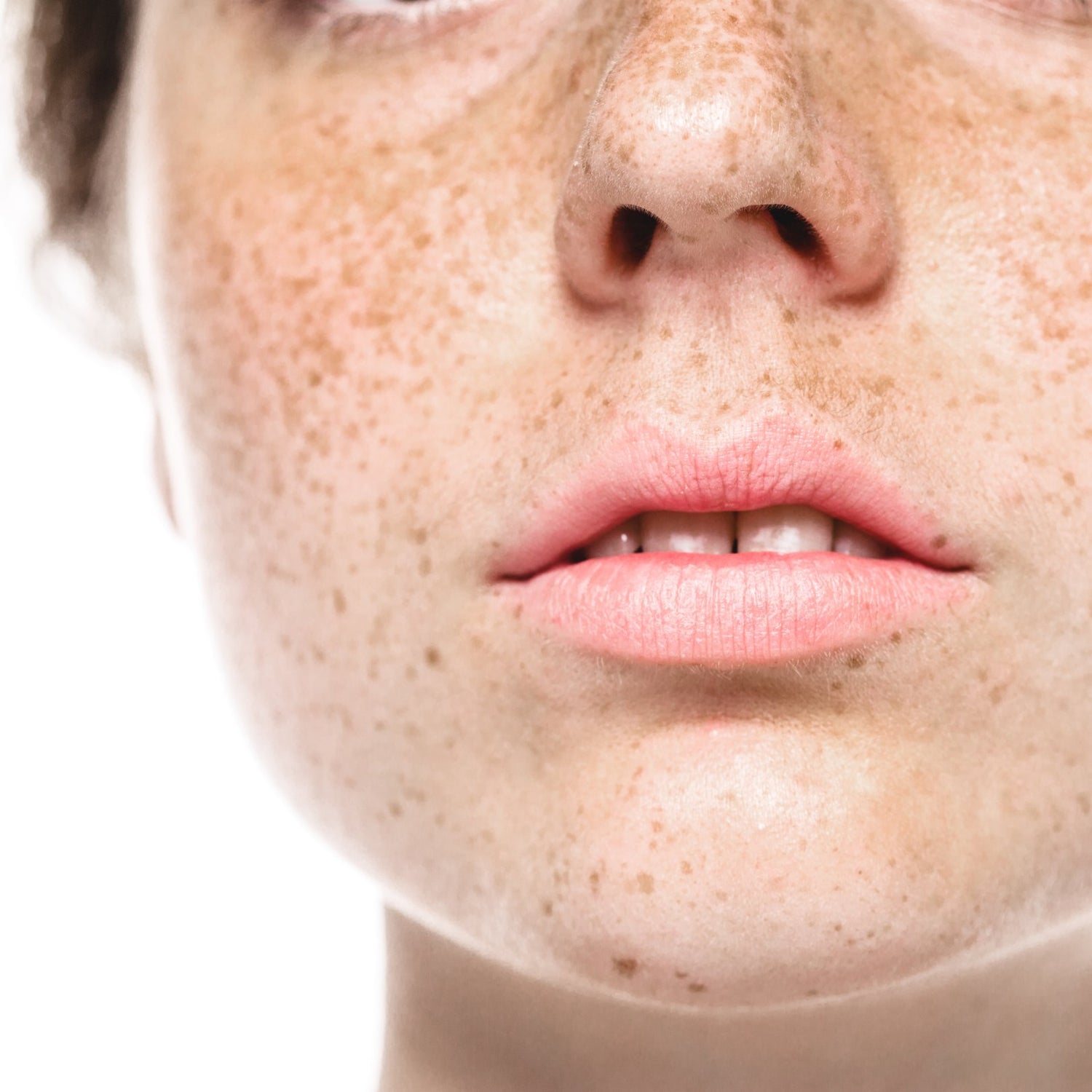 BRIGHTENING / PIGMENTATION