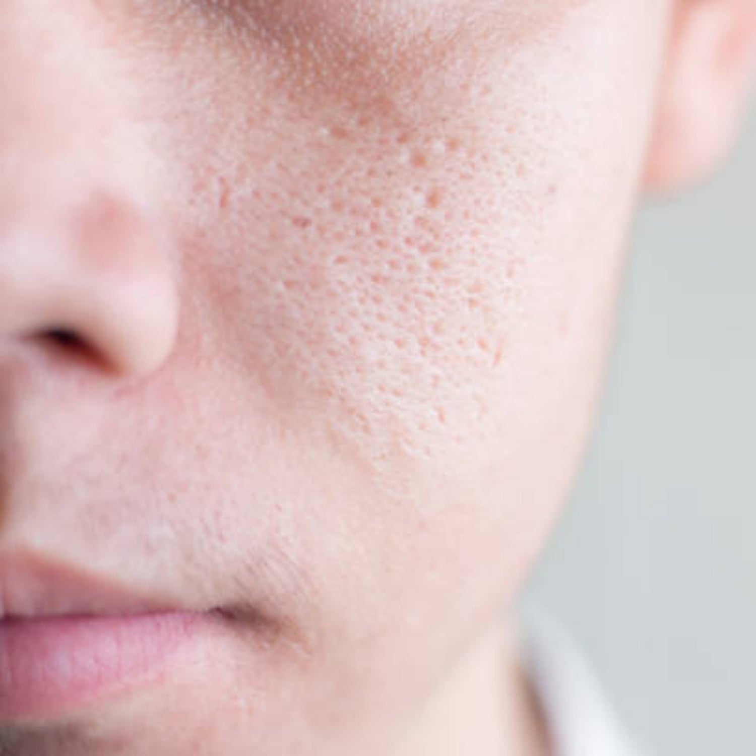 OILY / PORES
