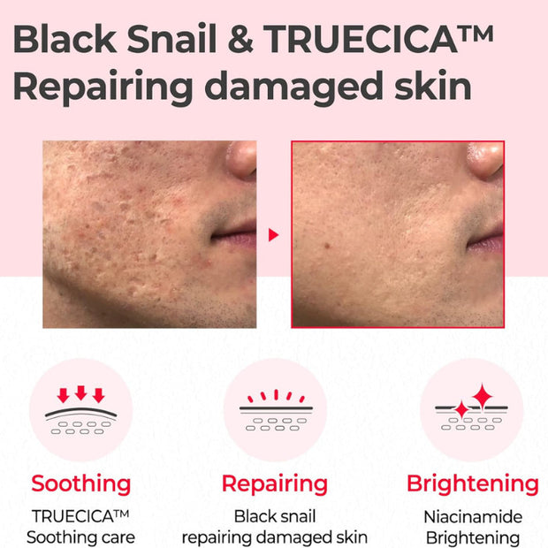Somebymi SnaiI Truecica FULL ROUTINE SET (Cleanser+toner+serum + cream)