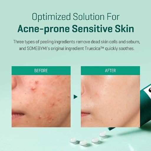 Some By Mi Super Miracle Spot All Kill Cream (acne spot care) 30ml