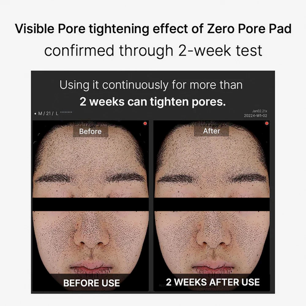 Medicube Zero Pore Pad 70pads