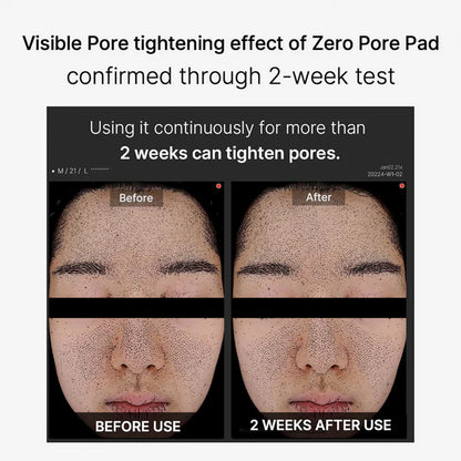 Medicube Zero Pore Pad 70pads