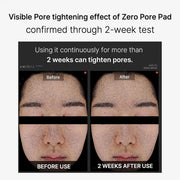 Medicube Zero Pore Pad 2.0 70pads