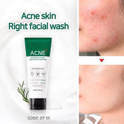 some by mi acne clear foam cleanser aha bha pha