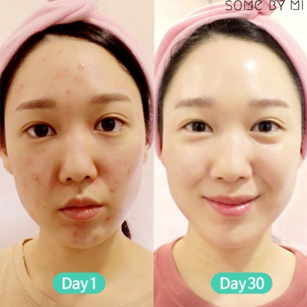 Some by mi AHA BHA PHA 30days Miracle Soap Cleansing Bar – Beauty Korea ...