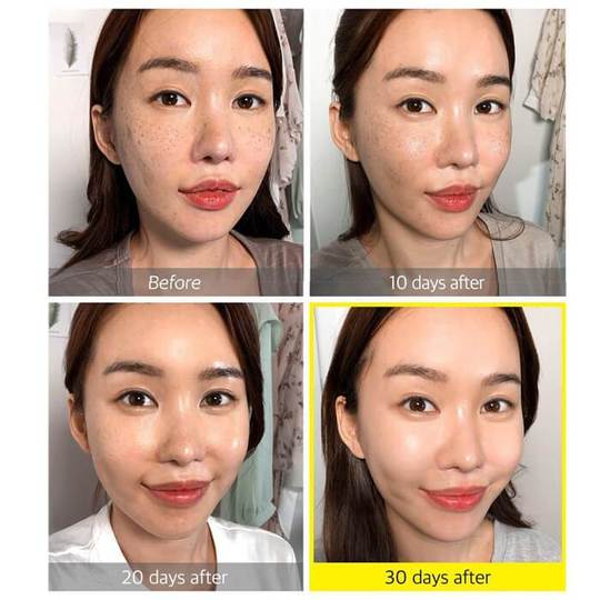 Some By Mi Yuja Niacin QUADRO Set - Beauty Korea Dubai