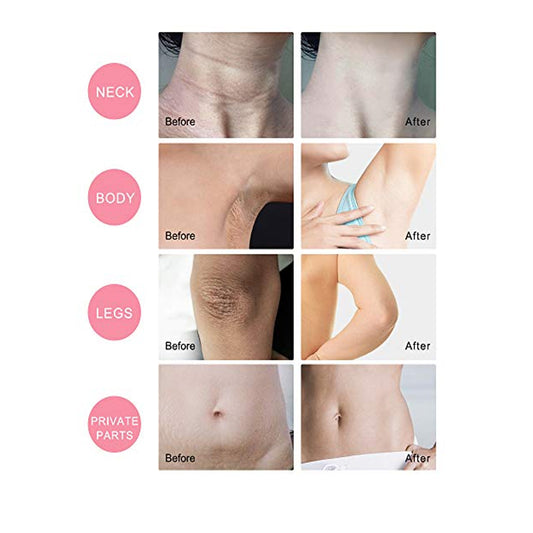PROOT Bleaching & Brightening Cream (Intimate areas, Butt, Thighs, Armpit & Elbows Brightening) ,80 ML - Beauty Korea Dubai